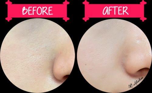Tinh chất sáng da , mờ vết thâm Cc Melano Nhật Bản, 20ml                 — ảnh 3