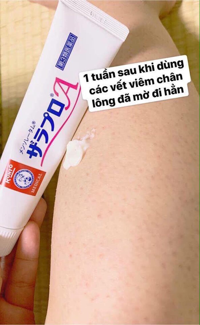 Kem trị viêm nang lông Rohto Mentholatum Zarapro A  — ảnh 2